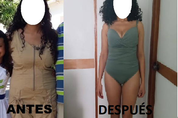 ANTES Y DESPUES CECI VESTIDO DE BAÑO.png